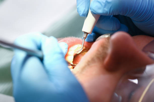 Best Emergency Treatment for Jaw Pain or Injury in Monticello, IL